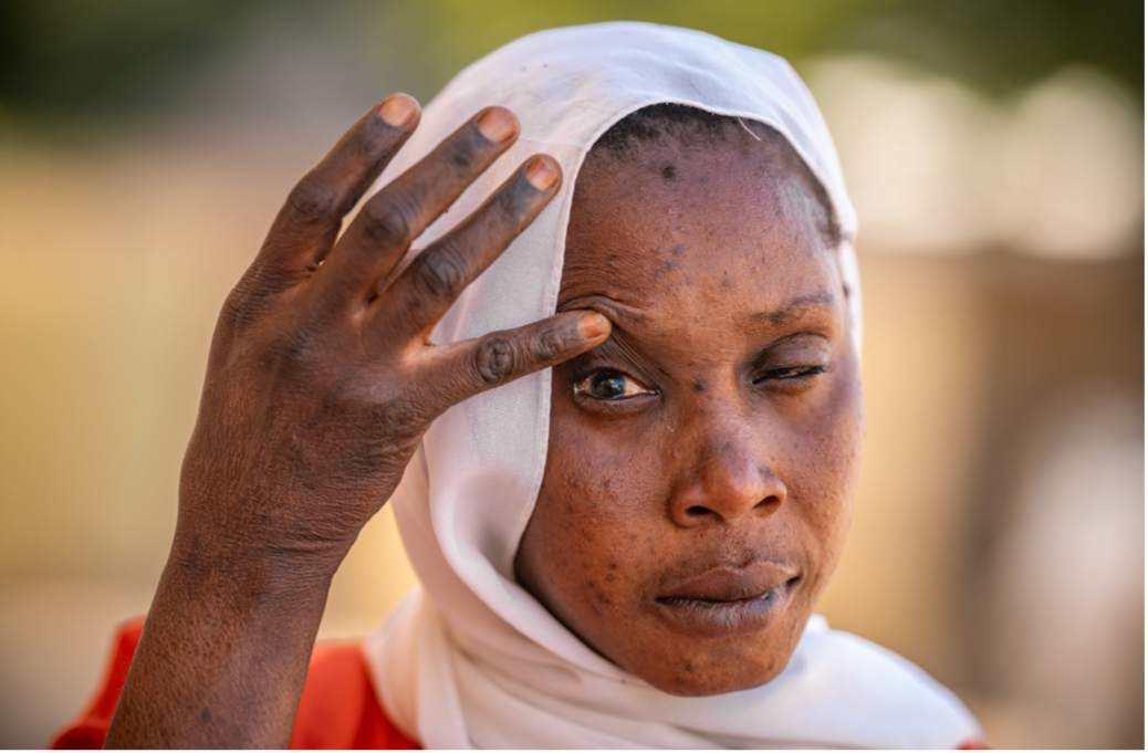 A woman in Senegal who was treated with Trachoma surgery and has restored pain-free sight. Credit: Speak Up Africa